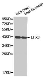 LHX8 Antibody in Western Blot (WB)