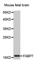 FABP7 Antibody in Western Blot (WB)