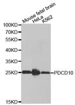 PDCD10 Antibody in Western Blot (WB)