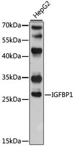 IGFBP-1 Antibody in Western Blot (WB)