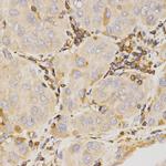 Kallikrein 5 Antibody in Immunohistochemistry (Paraffin) (IHC (P))