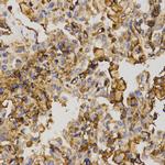 MRP5 Antibody in Immunohistochemistry (Paraffin) (IHC (P))