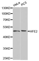 HFE2 Antibody in Western Blot (WB)