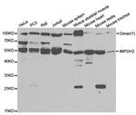 IMPDH2 Antibody in Western Blot (WB)