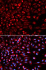 NEK2 Antibody in Immunocytochemistry (ICC/IF)