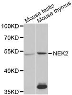 NEK2 Antibody in Western Blot (WB)