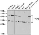 VAPB Antibody in Western Blot (WB)