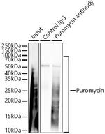 Diazepam Binding Inhibitor Antibody in Immunoprecipitation (IP)