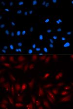 EBP1 Antibody in Immunocytochemistry (ICC/IF)