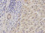 ADAM9 Antibody in Immunohistochemistry (Paraffin) (IHC (P))