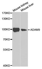 ADAM9 Antibody in Western Blot (WB)