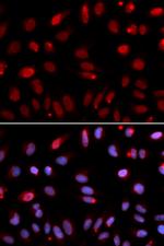 HUS1 Antibody in Immunocytochemistry (ICC/IF)