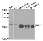 NPC2 Antibody in Western Blot (WB)