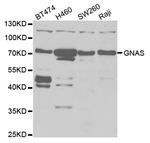 GNAS Antibody in Western Blot (WB)