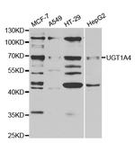 UGT1A4 Antibody in Western Blot (WB)