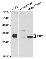 PNMT Antibody in Western Blot (WB)