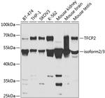 TFCP2 Antibody in Western Blot (WB)