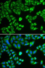 SH2B1 Antibody in Immunocytochemistry (ICC/IF)