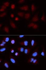 SH2B1 Antibody in Immunocytochemistry (ICC/IF)