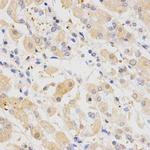 SH2B1 Antibody in Immunohistochemistry (Paraffin) (IHC (P))