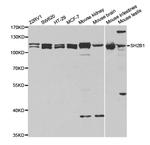 SH2B1 Antibody in Western Blot (WB)