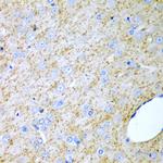 INHA Antibody in Immunohistochemistry (Paraffin) (IHC (P))