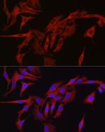 TMPRSS2 Antibody in Immunocytochemistry (ICC/IF)