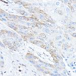 TMPRSS2 Antibody in Immunohistochemistry (Paraffin) (IHC (P))