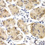 Chitotriosidase Antibody in Immunohistochemistry (Paraffin) (IHC (P))