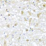 ATP2C1 Antibody in Immunohistochemistry (Paraffin) (IHC (P))