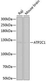 ATP2C1 Antibody in Western Blot (WB)