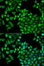 ABAT Antibody in Immunocytochemistry (ICC/IF)