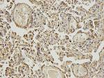 ABAT Antibody in Immunohistochemistry (Paraffin) (IHC (P))