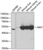 ABAT Antibody in Western Blot (WB)