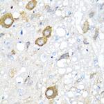 MGP Antibody in Immunohistochemistry (Paraffin) (IHC (P))