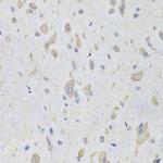 EEF1B2 Antibody in Immunohistochemistry (Paraffin) (IHC (P))