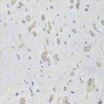 EEF1B2 Antibody in Immunohistochemistry (Paraffin) (IHC (P))