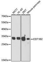 EEF1B2 Antibody in Western Blot (WB)