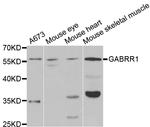 GABRR1 Antibody in Western Blot (WB)