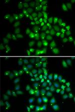 PCGF6 Antibody in Immunocytochemistry (ICC/IF)