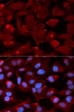 SMARCB1 Antibody in Immunocytochemistry (ICC/IF)