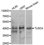 NPRL2 Antibody in Western Blot (WB)