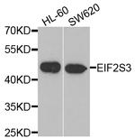 eIF2 gamma Antibody in Western Blot (WB)