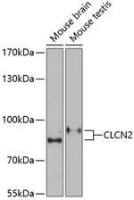 CLCN2 Antibody in Western Blot (WB)