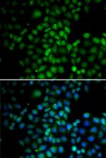 C11orf30 Antibody in Immunocytochemistry (ICC/IF)