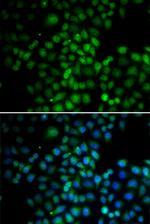 C11orf30 Antibody in Immunocytochemistry (ICC/IF)