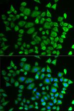 P4HTM Antibody in Immunocytochemistry (ICC/IF)