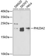 PHLDA2 Antibody in Western Blot (WB)