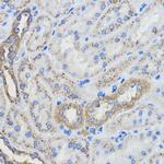 CYP51A1 Antibody in Immunohistochemistry (Paraffin) (IHC (P))