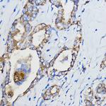 CYP51A1 Antibody in Immunohistochemistry (Paraffin) (IHC (P))